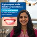 Invisible Braces In Sadashivanagar
