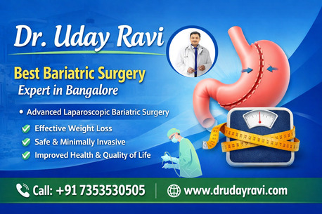 Bangalore, Health, Dr. Uday Ravi Is The Best Bariatric Surgery Expert In Bangalore.