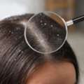 Effective Dandruff Treatment In Gurgaon &ndash; Get Healthy, Flake-Free Scalp