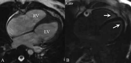 Mumbai, Medical, Same Day Reports - Cardiac MRI Scan In Mumbai By Picture This