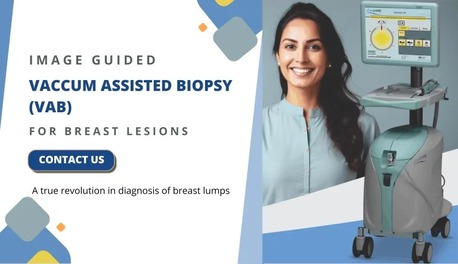 Mumbai, Medical, Advanced Vacuum Assisted Breast Biopsy At Picture This