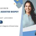Advanced Vacuum Assisted Breast Biopsy At Picture This