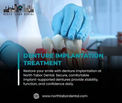 Los Angeles, Dental, Benefits Of Denture Implantation For Active Lifestyles !