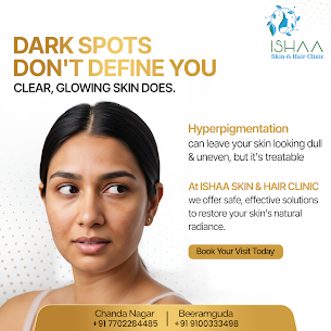 Hyderabad, Health, Hyperpigmentation Treatment In Beeramguda