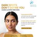 Hyperpigmentation Treatment In Beeramguda
