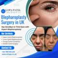 Blepharoplasty Surgery In UK By Dr Lopa Patel