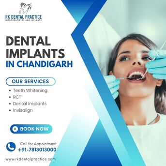 Chandigarh, Dental, Dental Implants In Chandigarh