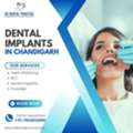 Dental Implants In Chandigarh