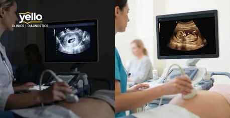 Hyderabad, Health, Early Pregnancy Scan In Hyderabad | Accurate & Safe Ultrasound