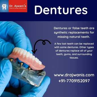 Pune, Dental, Safe And Effective Full Mouth Implant In Pune