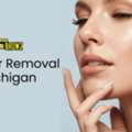 Laser Hair Removal In Michigan: Complete 2026 Guide