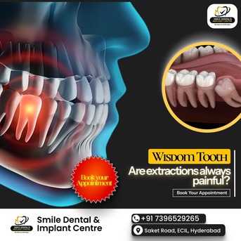 Hyderabad, Dental, Painless Wisdom Tooth Extraction In AS Rao Nagar At Smile Dental And Implant Centre