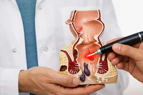 Rohini, Health & Beauty Items, Specialized Treatment Care For Piles Fissure And Digestive Issues Delhi | Centre For Piles