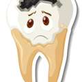 Understanding Tooth Decay: Causes, Symptoms, And Prevention