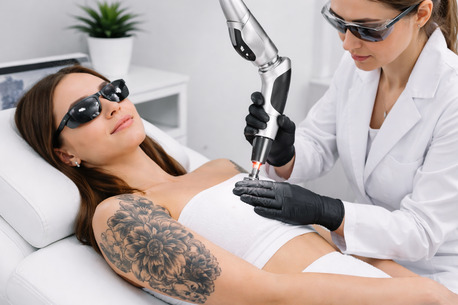 Dubai, Health, Laser Tattoo Removal In Dubai: Procedure, Results, And Expert Advice