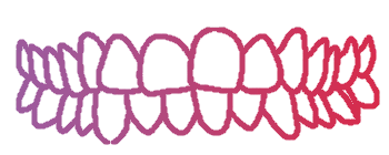 Chennai, Dental, Crowded Teeth Braces Without Extraction In Tamil Nadu