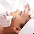 How To Maximize The Benefits Of Carbon Laser Peel Treatment