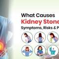 Learn The Main Causes Of Kidney Stones & Prevention Tips