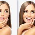 Acne Vs Acne Scars: Finding The Right Treatment For Clearer Skin