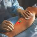 Advanced Care For Varicose Vein Conditions