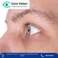 Core Vision Eye &ndash; Top  Keratoconus Treatment In Ahmedabad