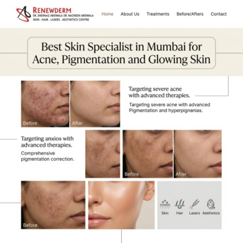 Mumbai, Health, Best Skin Specialist In Mumbai For Acne, Pigmentation And Glowing Skin
