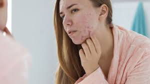 New York, Health, Clear Skin Starts With Targeted Treatment