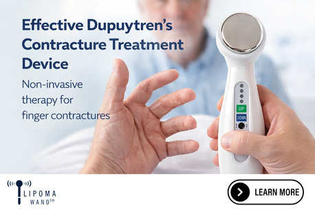 New York, Health & Beauty Items, USD 177,  At Home Dupuytren Contracture New Treatment Device