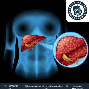 Mumbai, Health, Leading Liver Transplant Doctor In Mumbai With Expert Team