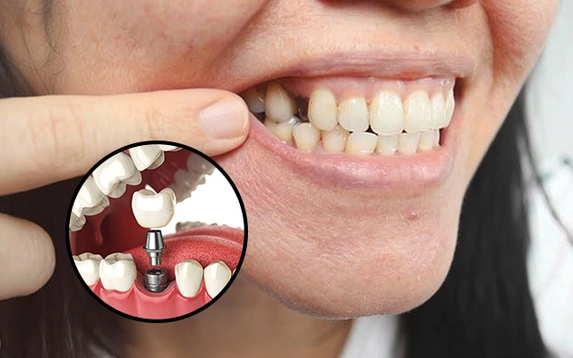 Kolkata, Health, Best Dental Clinic In Rashbehari For Pain Free Treatment