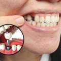 Best Dental Clinic In Rashbehari For Pain Free Treatment