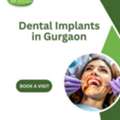 Dental Implants In Gurgaon - Thyme Dental