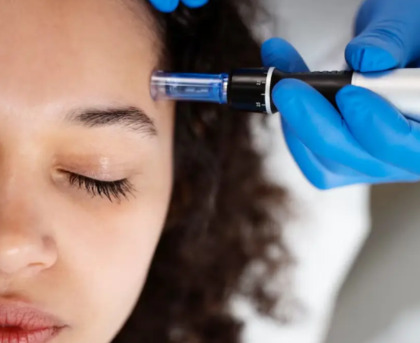 New York, Business, Lip Filler In Covina, CA