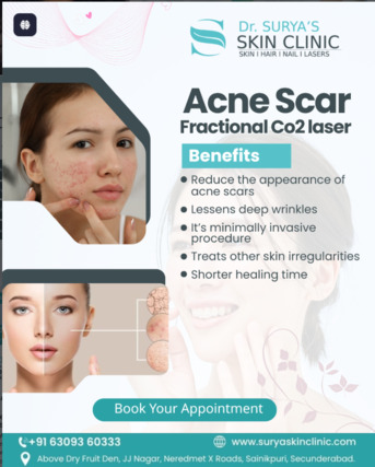 Hyderabad, Health, Effective Pigmentation Treatment In Secunderabad