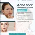 Effective Pigmentation Treatment In Secunderabad