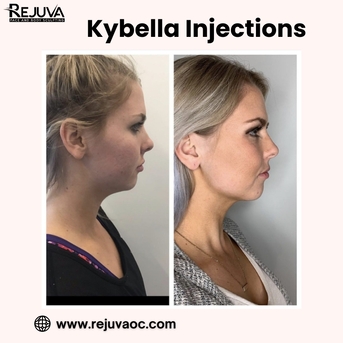 New York, Beautician, Professional Kybella Injections In Newport Beach