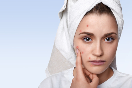 Dubai, Health, Acne Treatment Dubai: Modern Dermatology For Long-Lasting Skin Health