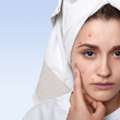 Acne Treatment Dubai: Modern Dermatology For Long-Lasting Skin Health