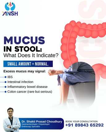 Bhubaneswar, Health, Mucus In Stool | Gastro Surgeon In Bhubaneswar | Dr Shakti Prasad Choudhury.