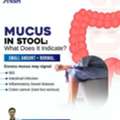 Mucus In Stool | Gastro Surgeon In Bhubaneswar | Dr Shakti Prasad Choudhury.