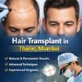 Effective Hair Transplant Solutions In Thane For Thinning Hair