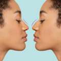 Non-Surgical Rhinoplasty &ndash; Smooth, Shape & Enhance Your Nose Instantly