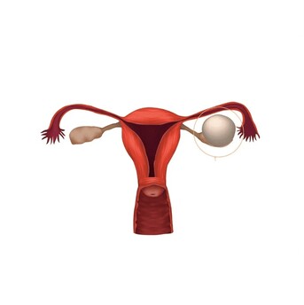 Faridabad, Health, Trusted Ovarian Cyst Treatment Doctor In Faridabad Today