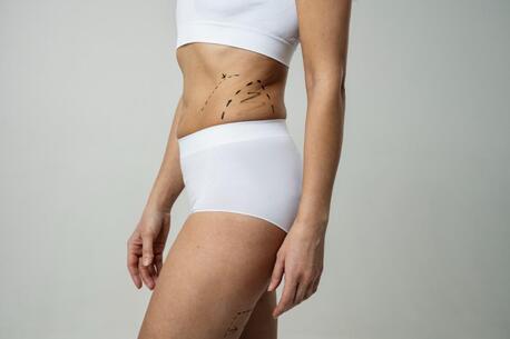 Cape Town, Health, Transform Your Body Shape With Advanced Liposuction Treatment
