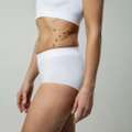 Transform Your Body Shape With Advanced Liposuction Treatment