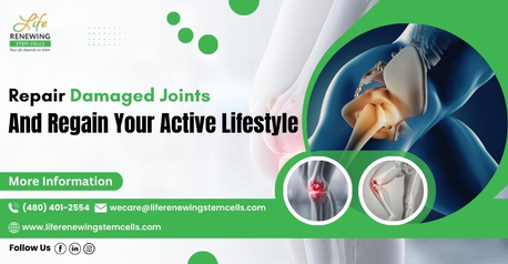 New York, Health, Repair Damaged Joints And Regain Your Active Lifestyle