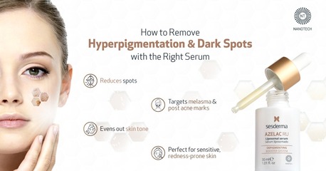 Mumbai, Health & Beauty Items, INR 2650,  What Is The Best Anti Dark Spot Serum For Indian Skin?