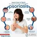 Psoriasis Signs And Management- Dermacure