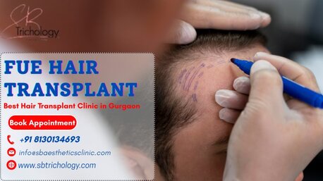 Gurgaon, Health, Best Clinic For FUE Hair Transplant In Gurgaon | SB Trichology