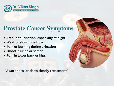 Indore, Health, BPH Treatment Doctor Indore For Enlarged Prostate